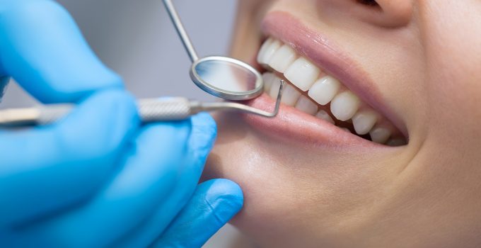 What is Gum Recession