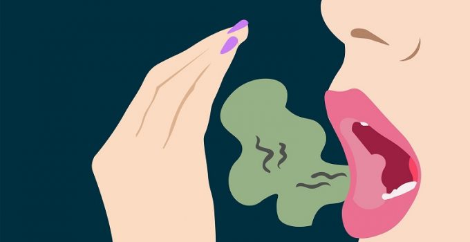 What is Halitosis?